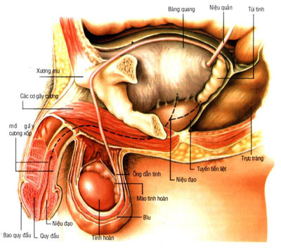 u xơ tiền liệt tuyến