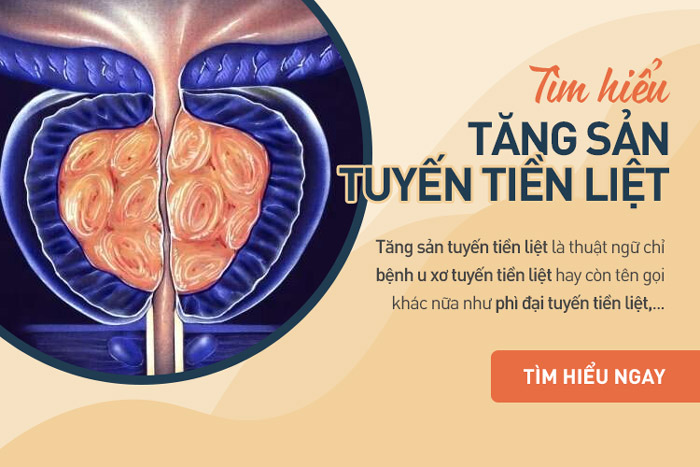 Tăng sản tuyến tiền liệt là gì? Nguyên nhân và điều trị