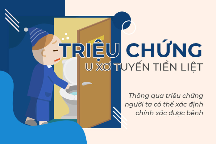 Cảnh báo 15 triệu chứng u xơ tuyến tiền liệt