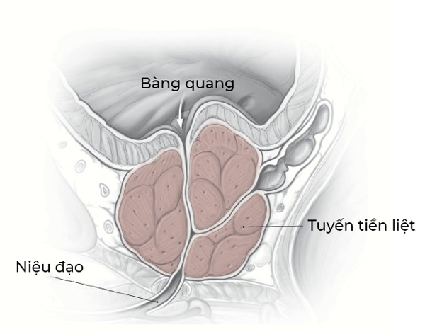 kích thước tuyến tiền liệt bình thường là bao nhiêu