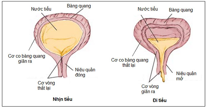 cách trị khó tiểu tại nhà