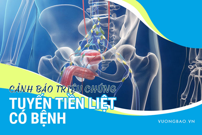 Cảnh báo các triệu chứng tiền liệt tuyến có bệnh