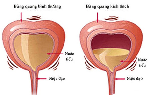 Vì sao trời lạnh lại mắc tiểu nhiều