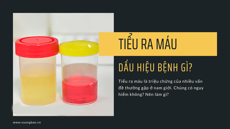 Tiểu ra máu đại thể