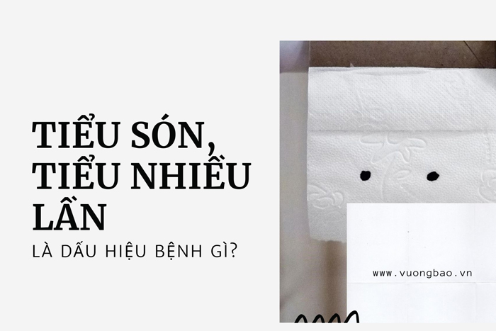 Tiểu són tiểu nhiều lần là dấu hiệu của bệnh gì?