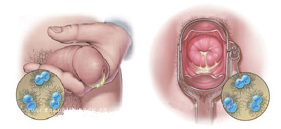 đi tiểu bị buốt ở nam