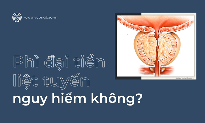 Phì đại tiền liệt tuyến có nguy hiểm không?