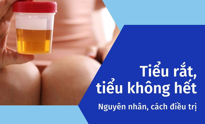 Tiểu rắt tiểu không hết: Nguyên nhân và cách điều trị